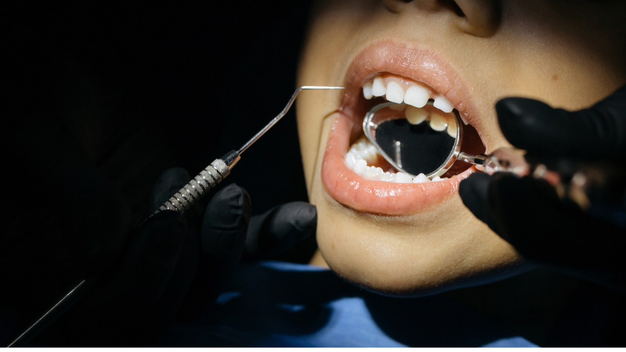 4 Effects of Substance Abuse on Your Dental Health