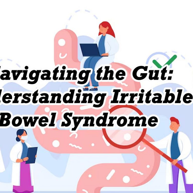 Irritable bowel syndrome